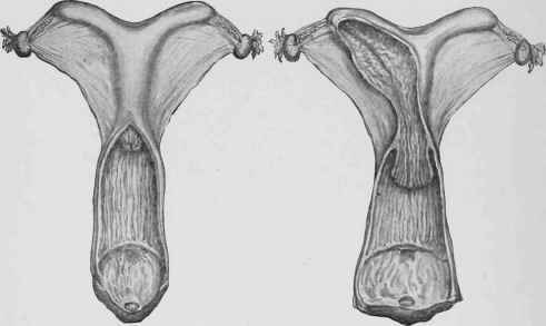 Uteri with Short and Long Necks.