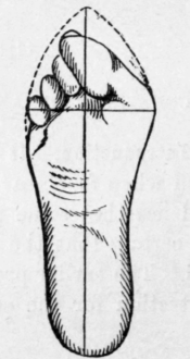 Fig.3.