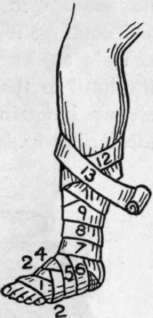 Figure 8 of the Leg Forehead or Back of Head
