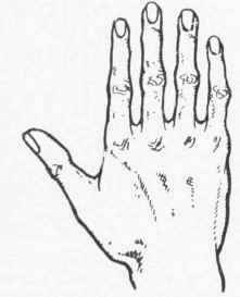 Fig. 4    'he Philosophic Hand. This is the hand common among Orientals, among people ever seeking wisdom, and who delight in the mysterious and in studying mankind.