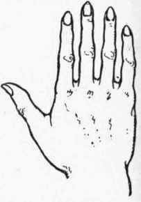 Fig. 6.   The Psychic Hand. This type of hand is rarely found pure. It is possessed by people who are essentially unpractical and unbusinesslike.