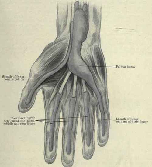 Fig. 380.   Palmar bursa and sheaths of the flexor tendons distended with wax.