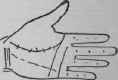 V The Third Or Outer Angle 980