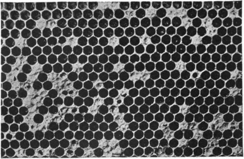 American foulbrood in advanced stage.