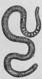 Trichina Spiralis   Female