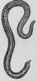 Trichina Spiralis   Male