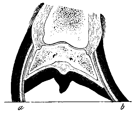Fig. 85.   Section Through A Crooked Foot