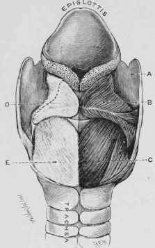Fig;. 207.   Larynx of a  Roarer.