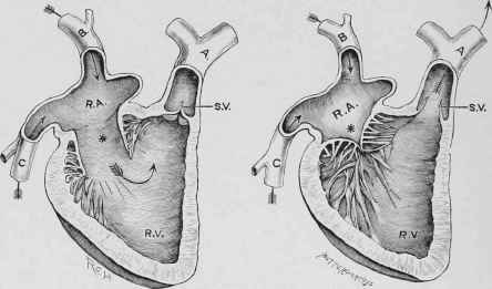 Figs. 189 and 190.   Diagrammatic Views of the Heart, showing Valves open and closed.