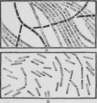 Bacillus anthracis A, Bacilli in chains. B, Bacilli disconnected.