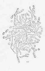 EXTERNAL PARASITES OF THE HORSE After Neumann.