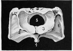 Fig. 2. ATLAS (antero  inferior surface).