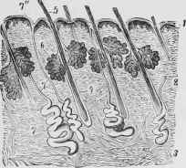 Section of Skin, showing Glands and Hair Follicles.