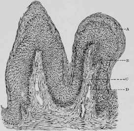 Section of Wart.