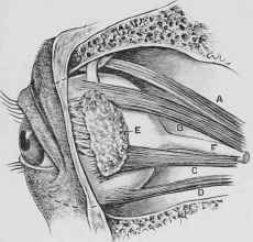 The Eye, showing the Lachrymal Gland.