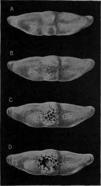 Fig. 402   Navicular Disease.