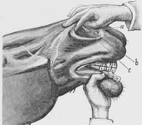 Examination of the Nostril.