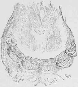 Fig. 60S. Incisors of Cart Filly at two years.