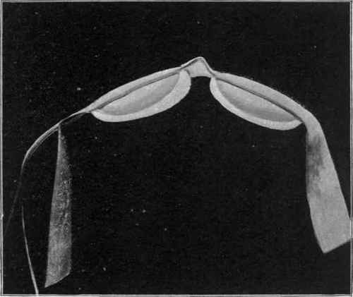 Arrangement to prevent the Roller pressing on the withers.