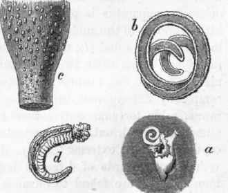 Trichina spiralis.
