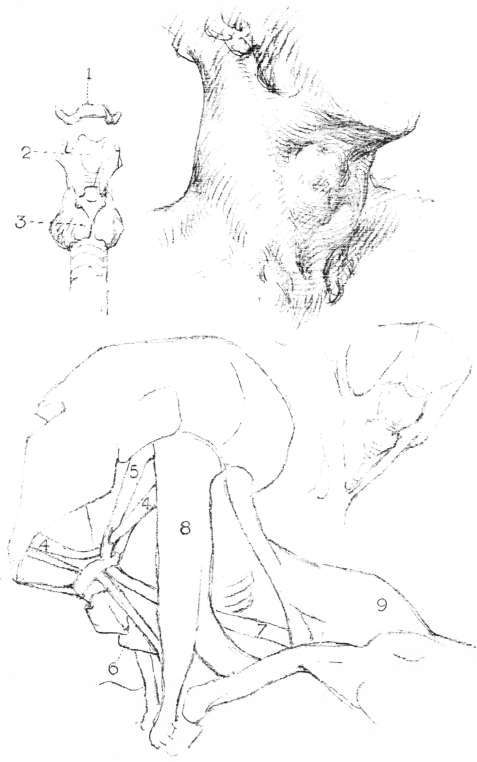 The Neck. Tongue Bone and Larynx 1 Hyoid bone.