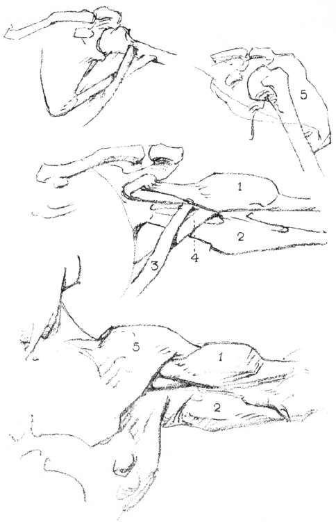 The Shoulder. Mechanism of the Armpit, front view: 1 Biceps.