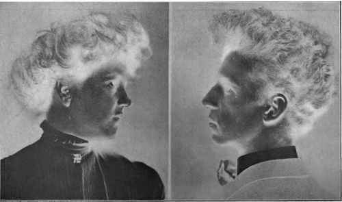 Examples of Unretouched Negatives   Profile Views