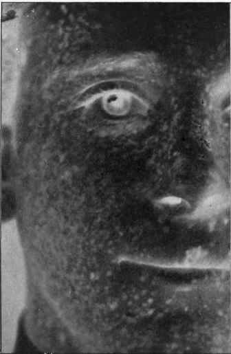 Fig. 1 Section of Face Enlarged