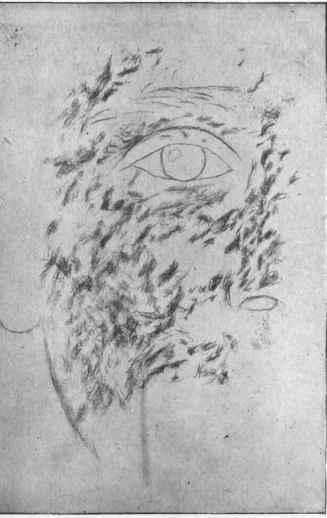 Fig. 2 Pencil Strokes Applied to Remove Freckles