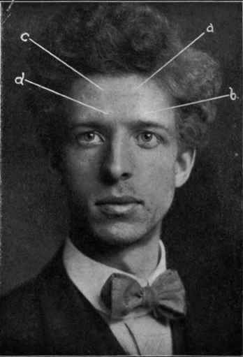 Illustration No. 11 Plain Portrait Lighting Prominences of the Forehead See Paragraph 20
