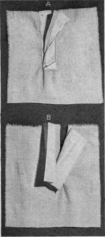 Fig. 140.   Invisible closing for petticoat; A, completed facing; B, detail of facing.