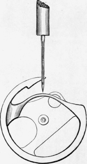 Fig. 198.