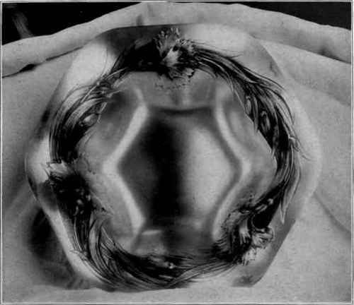 Fig. 138. Silver fruit dish, chased carnations.