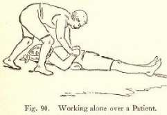Fig. 90. Working alone over a Patient.