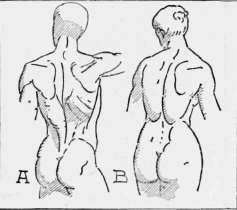 Fig. 4.   Comparative Back Views.