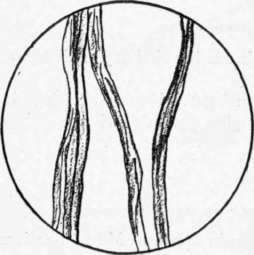 Fig. 77.   Silk fibers magnified.