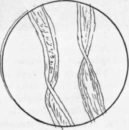 Fig. 8.   Cotton fibers magnified.