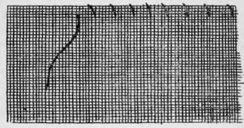 121-Overcasting-Stitch-193