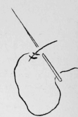 183-Tree-Stitch-281