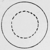 19-Button-Stitches-31