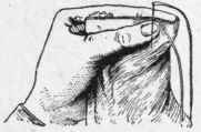 Fig. 21. Work held for oversewing.