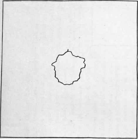 Fig. 27. Representing a hole in a garment.