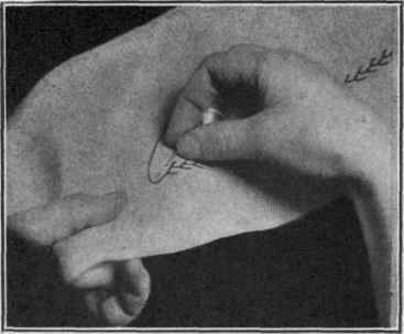 Figure 20.