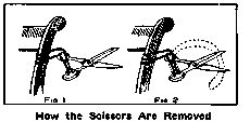 How the Scissors Are Removed