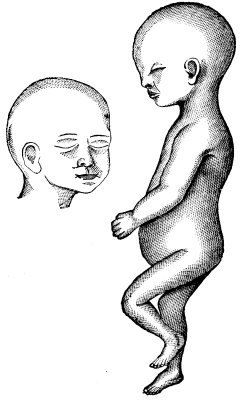 The Developmental Significance Of Human Physiognom 392 12b