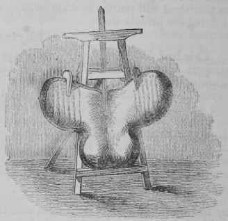 The Breast Plate Or Hunting Plate 114