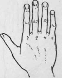 Fig. 3.   The Spatulate Hand denotes a love of independence, restlessness, and originality. Inventors and travellers usually possess this type of hand.