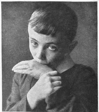 The immediate treatment of a dog or cat bite