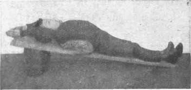 Fig. 2. To cure round shoulders, the child lies on an inclined plane