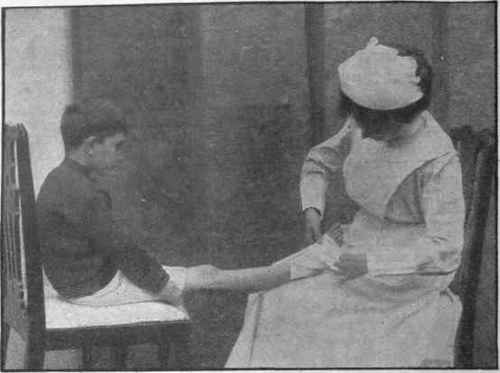 Bandaging the foot. The nurse is making reverses over the front of the foot to make the bandage lie smoothly reverses may have to be made on the centre of the roots of the toes.